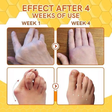 "Reveal Radiant Skin, Banish Unsightly Veins"